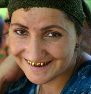 Une femme rom sourit, dévoilant sa dentition en or