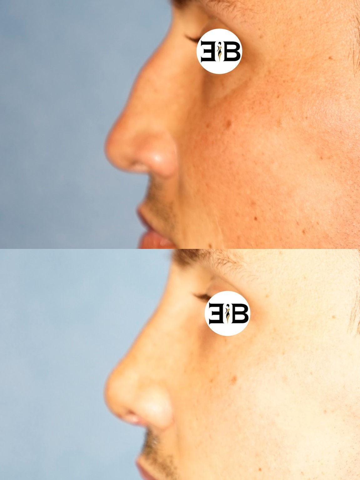 Slide2