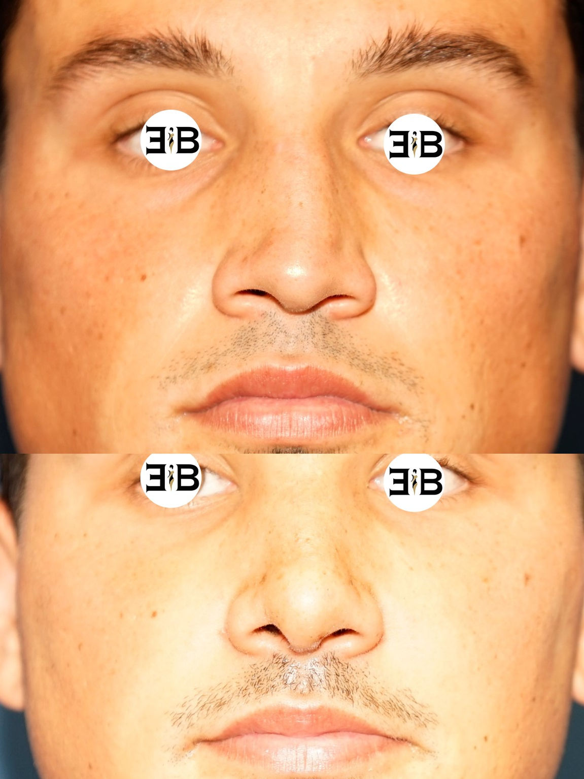 Slide3