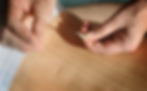 acupuncture-chinese-medicine-treatmen.jpg