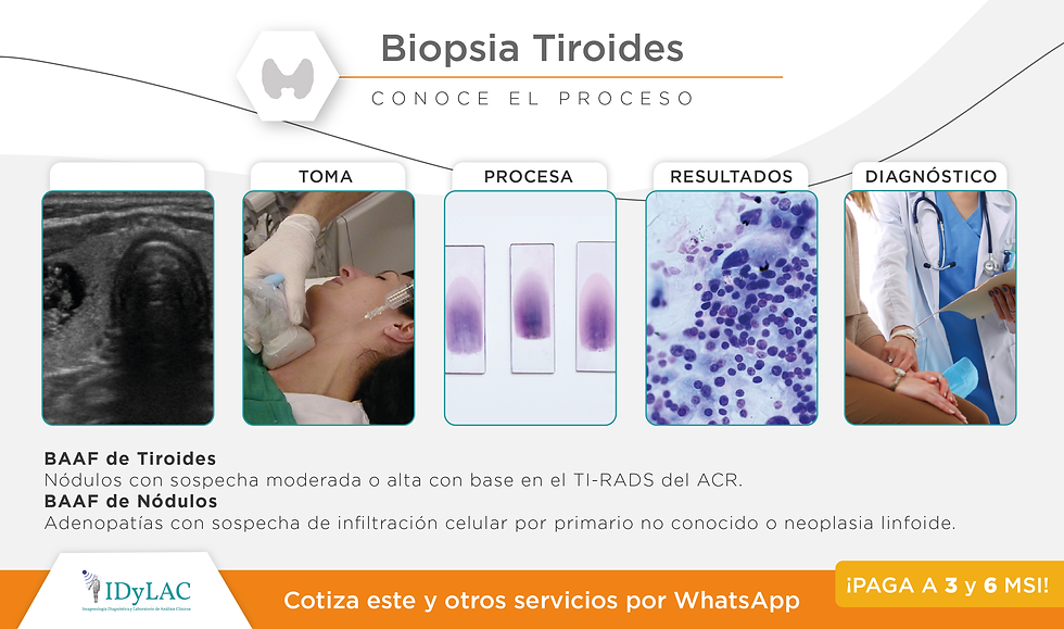 Biopsia Tiroides.png