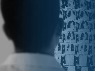 漏斗胸的六大类型