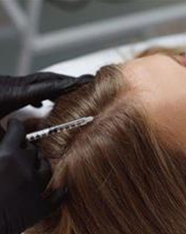 mezotherapy-for-hair.webp