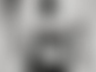 Abnehmen mit Lipödem - so kann es funktionieren