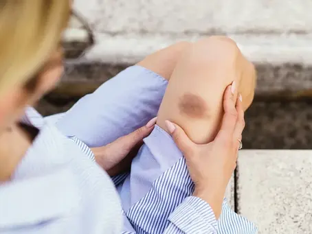 The Bruise News: Helping You Heal