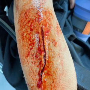 Casualty Makeup