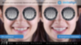 прозрачные элайнеры Invisalign.jpeg