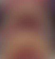 Miért veszélyes a fogkő, és hogyan távolítható el?