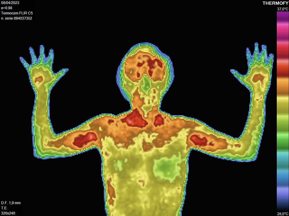 O que é acupuntura termoguiada?