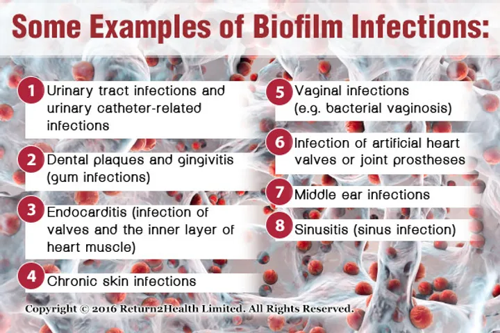 Biofilm Problem PROBLEMATIC BIOFILMS IN YOUR BODY - AND SOME THAT ARE PROTECTIVE