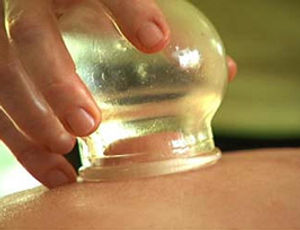 cupping