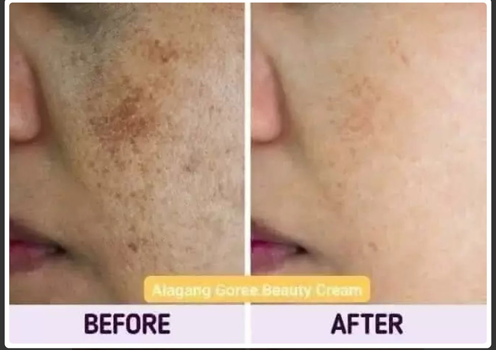 Thumbnail: GOREE Day & Night Whitening Cream