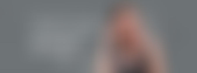 Quanto Tempo Devo Dar de Garantia para Minhas Clientes?