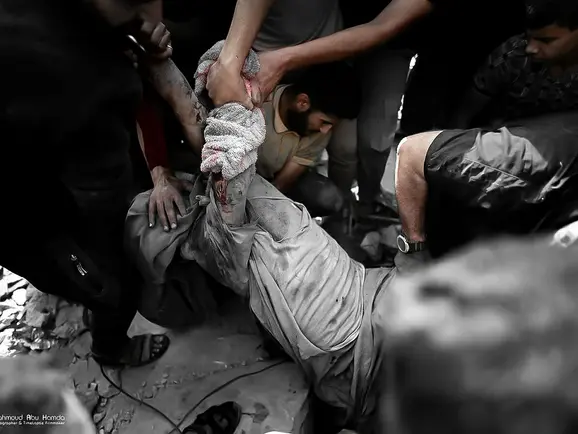 Crise sanitária se agrava no sul de Gaza em meio a bloqueio de ajuda e colapso da saúde pública
