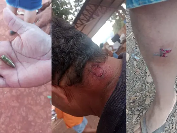 Violência policial na Reserva Indígena de Dourados deixa feridos e presos em protesto por água