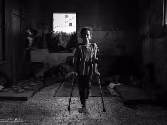 Refugiados com deficiência em Gaza enfrentam barreiras para acessar ajuda humanitária