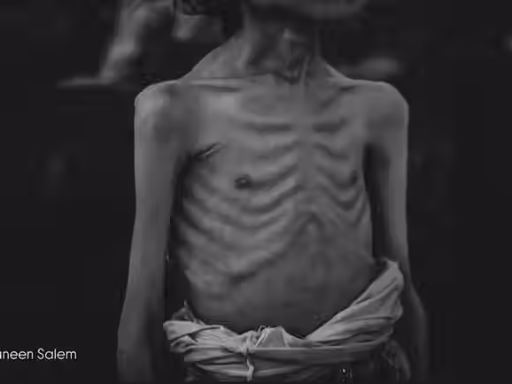 Pelo menos mais três palestinos morreram de fome nas últimas 24 horas