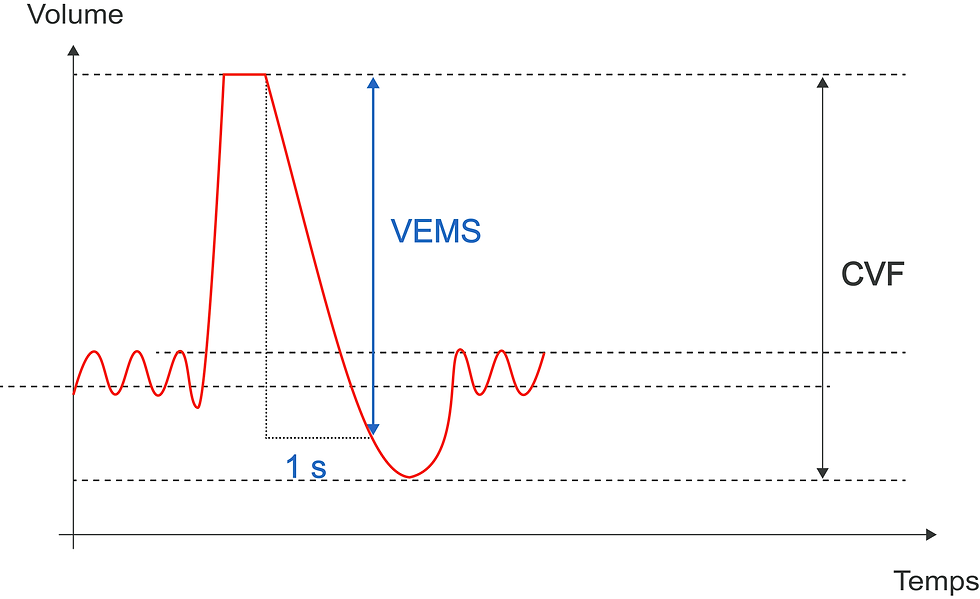 2-Mesure des débits