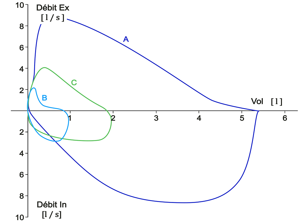 5-Courbes débit-volume