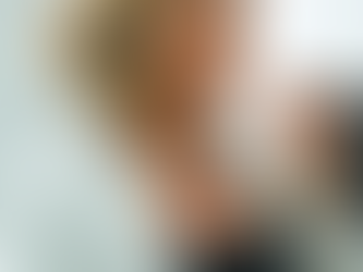 Clareamento Dental muito eficiente!