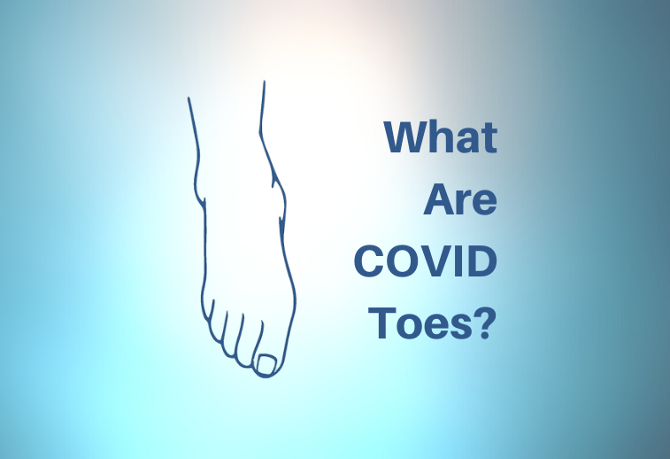 Covid Toes What is it and what to do about it