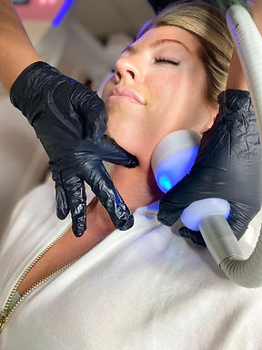 cryofacial.jpeg
