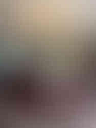 Cmn