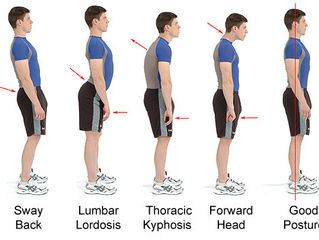 SPINAL/POSTURAL SCREENING