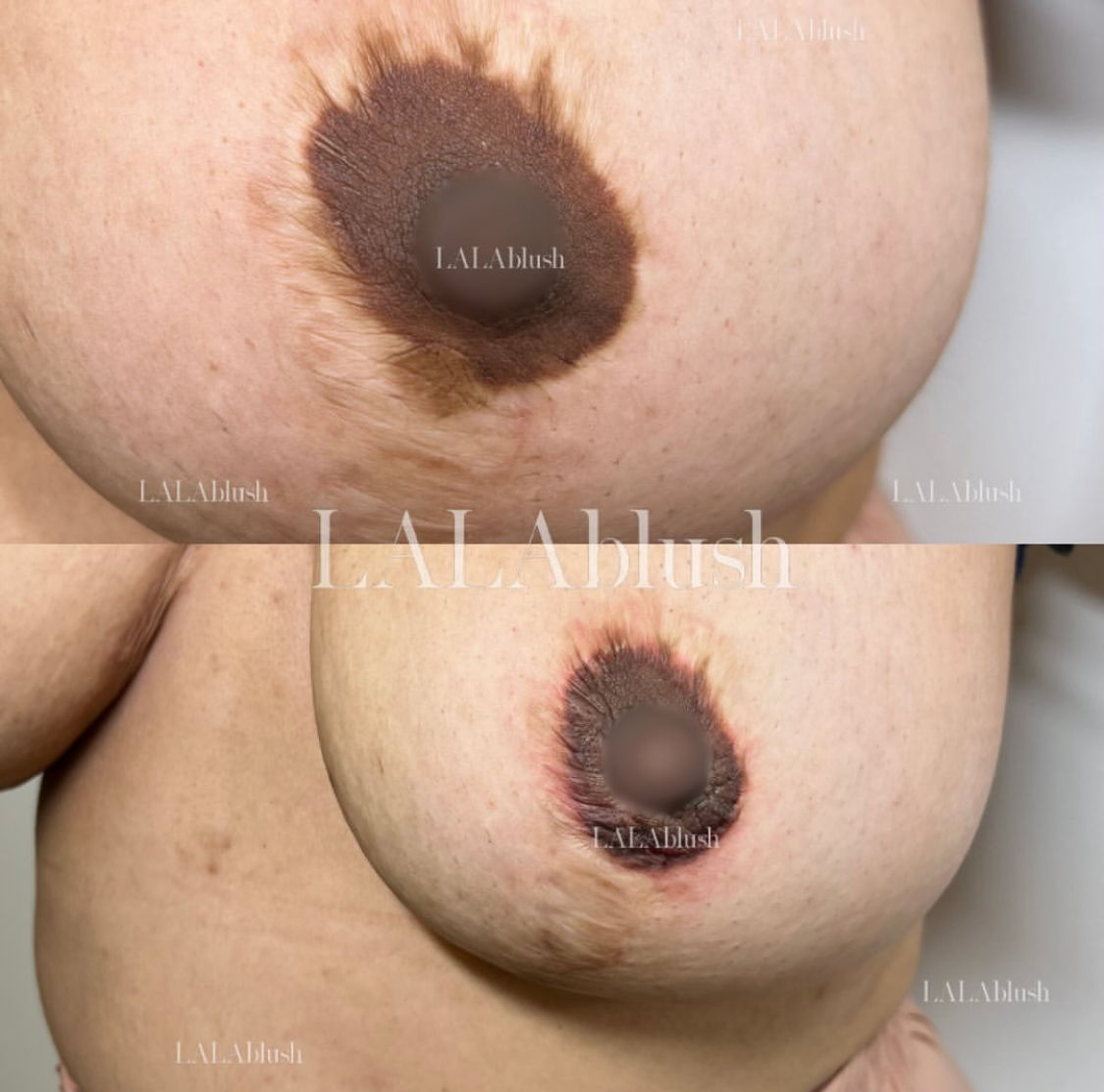 Pretty Ink | Medical Tattooing Clinic & Medspa