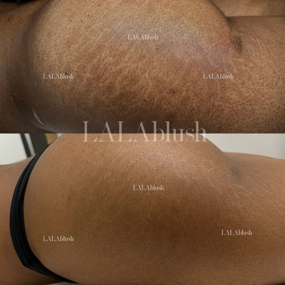 Pretty Ink | Medical Tattooing Clinic & Medspa