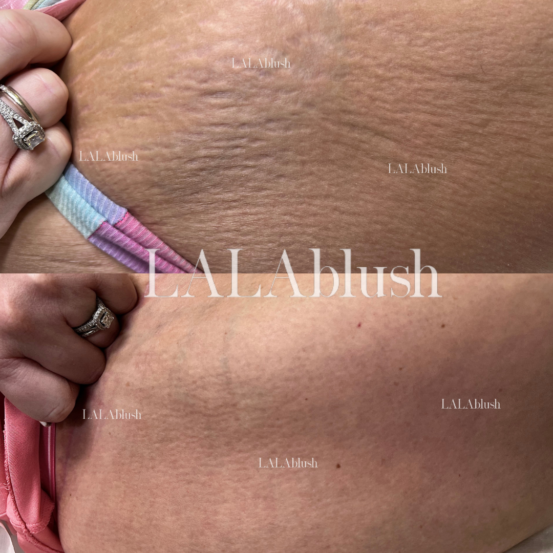 Pretty Ink | Medical Tattooing Clinic & Medspa