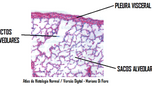 Ductos alveolares e Alvéolos