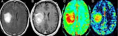 brain
