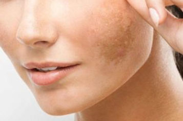 932e2f50-605d-0137-731d-6231c35b6685-min