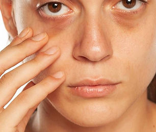 872b869ce44afee0ae4c214c955fb78a (1).jpg