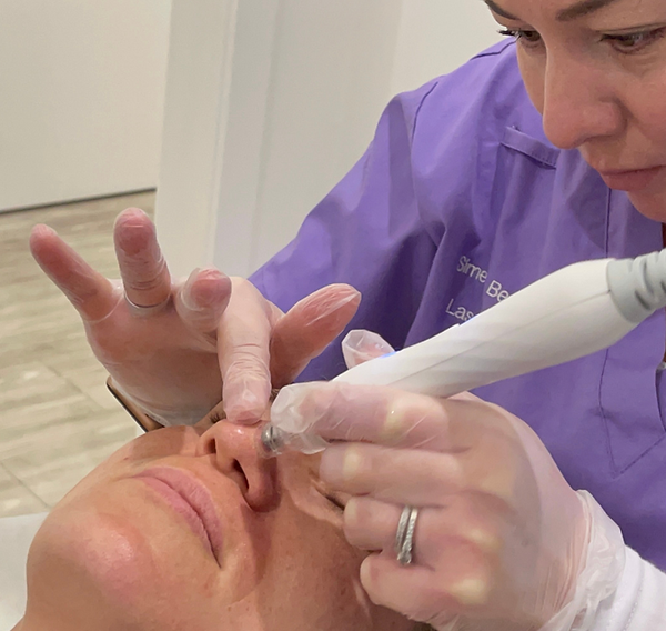 Shine with hydrodermabrasion and hydrafacials treatment and look flawless