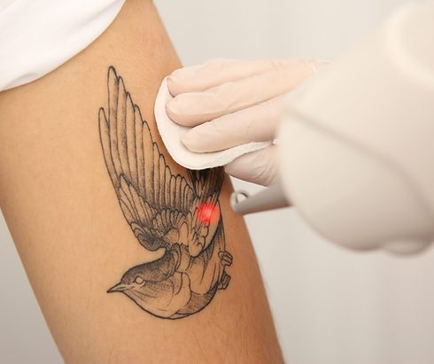 Tatto Simetics 3.png