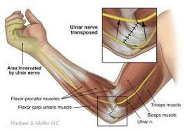 anterior transposition.jpg