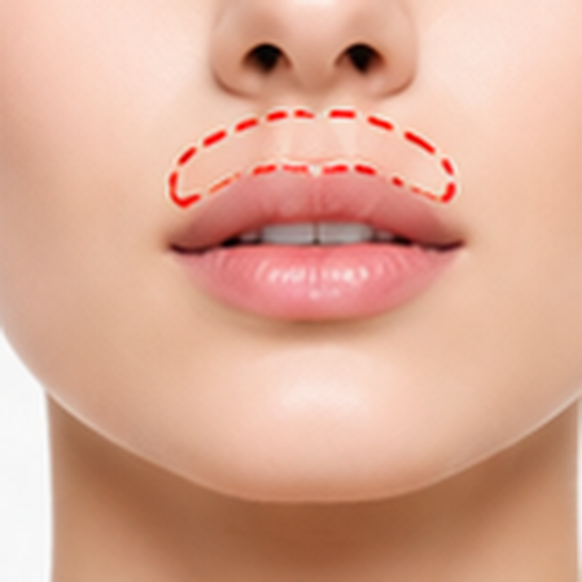 Upper lip