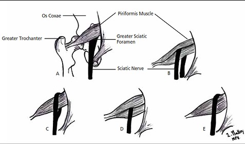 PiriformisAnatomy.png