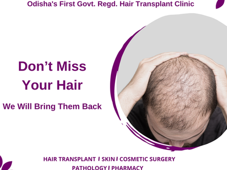 Avail of the Best Hair Transplant Doctors for Innovative Solutions.