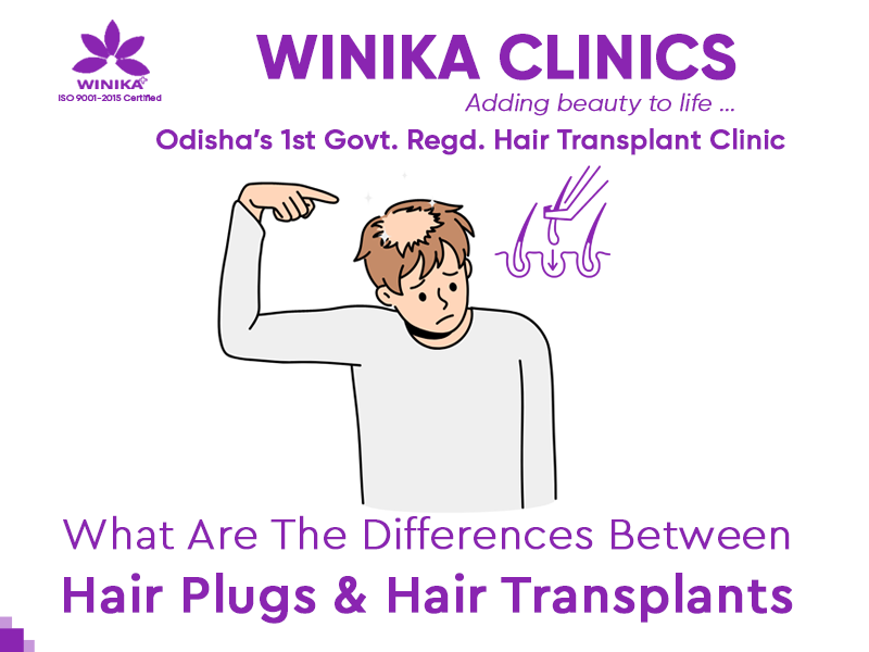 What Are The Differences Between Hair Plugs & Hair Transplants?