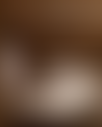 Spa lounge with striped loungers and a swimming pool, Swissotel Kolasin's interior.