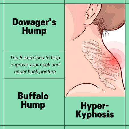 Best Dowager's Hump Exercises