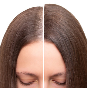 Before after white bg.jpeg