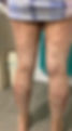Before online treatment.jpg