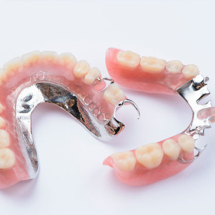 A picture of partial dentures. 