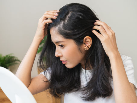 Fibrosing Alopecia in a Pattern Distribution (FAPD)