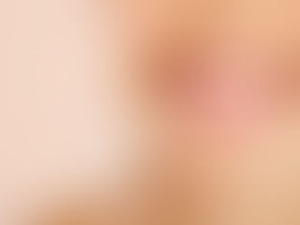 Diseño de sonrisa: cómo transformar tu imagen sin perder naturalidad