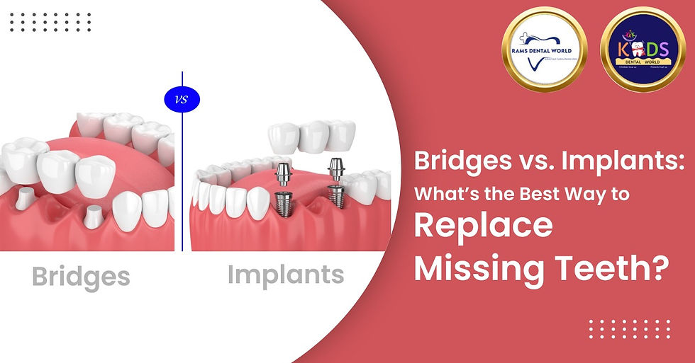 Bridges vs. Implants: What’s the Best Way to Replace Missing Teeth?